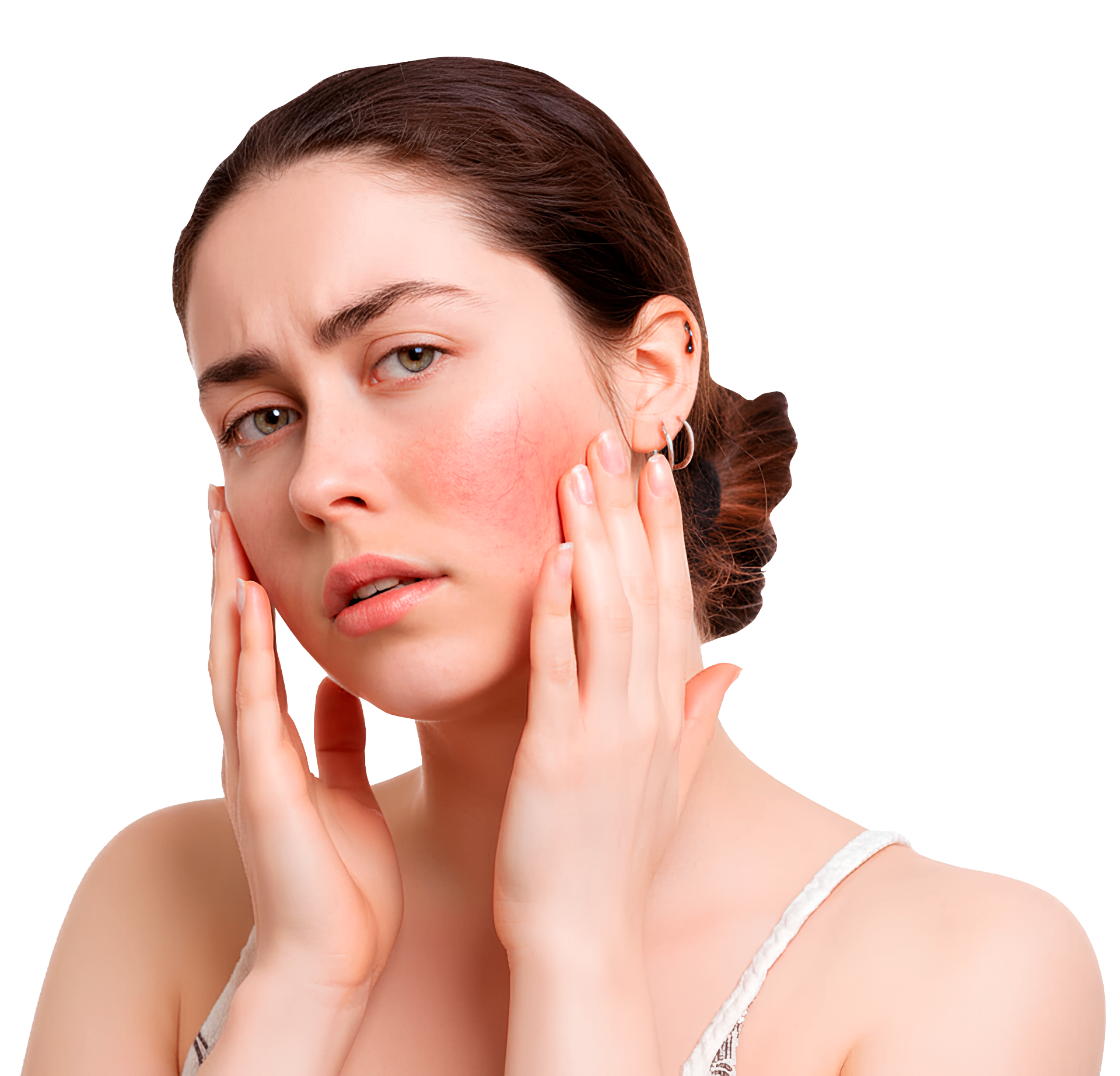 Profesional analizando una piel con rosácea